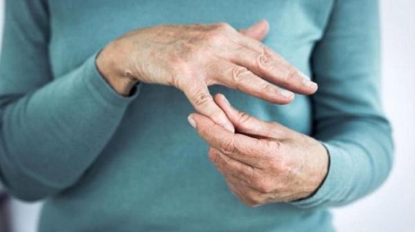 دانستنی هایی در ارتباط با بیماری آرتریت پسوریاتیک